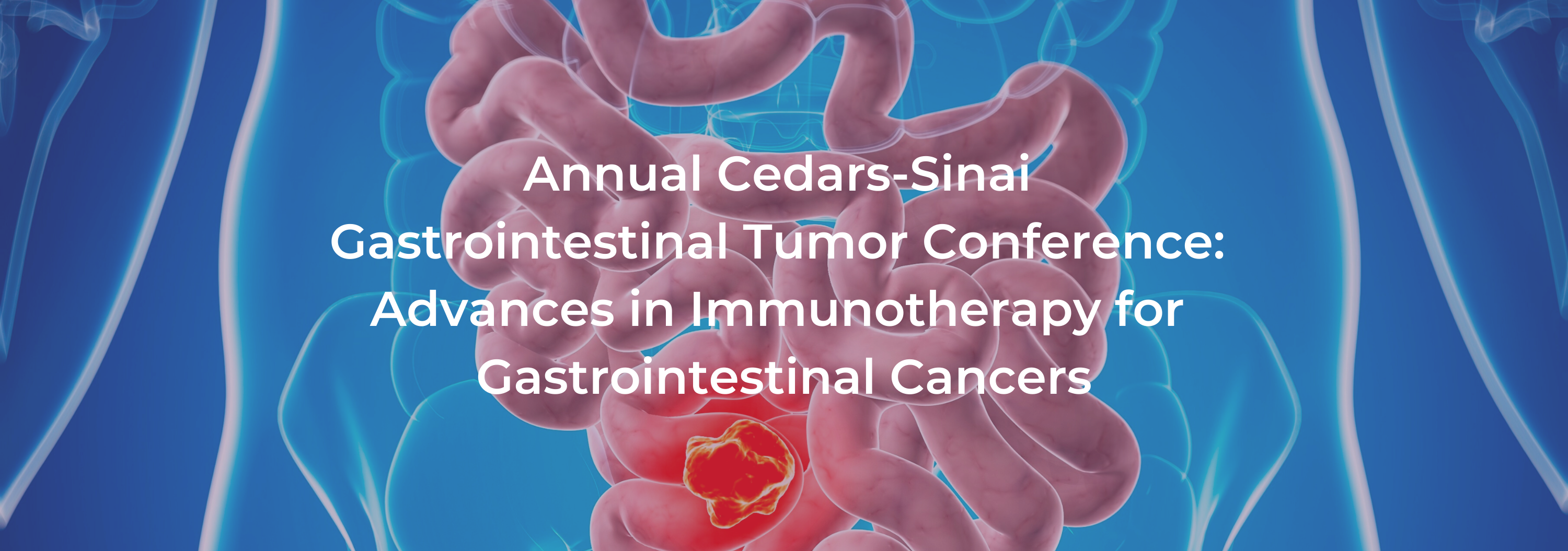 RESCHEDULED- 3rd Annual Cedars-Sinai Gastrointestinal Tumor Conference: Advances in Immunotherapy for Gastrointestinal Cancers Banner